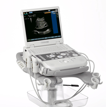 Image: The Acuson P300 ultrasound system (Photo courtesy of Siemens Healthcare).